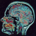 1432_brain5 1432_brain5