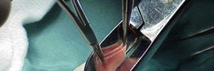 5430_circum