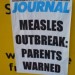 7352_measles