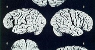 10688_einsteinsbrain