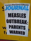 Measles_9Feb09.jpg