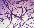 Bacillus anthracis