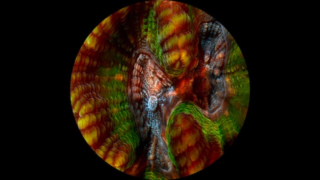 coral