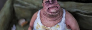 The dangers of obesity