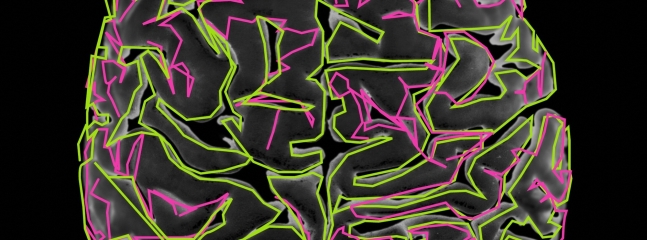 brainbrainbrain