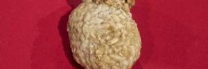 gallbladder