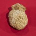 gallbladder gallbladder